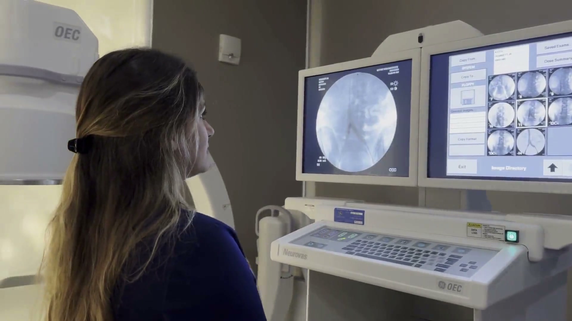 Megan reviewing venogram images on the procedure-room monitors at Gitter Vein Institute